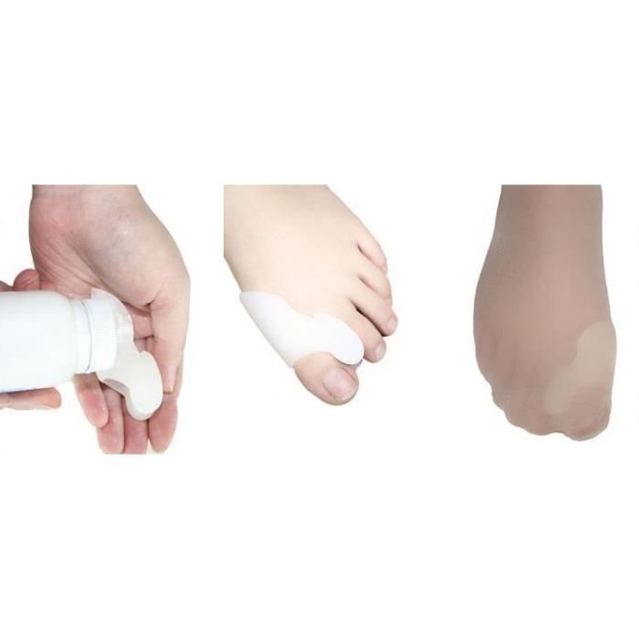 Silicone Hallux Valgus Orthosis