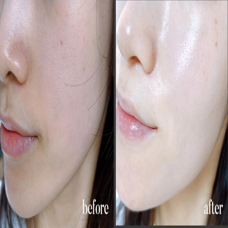 Shimoment Glutathione Pearl Whitening Beak-Ok Cream 50ml