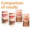 Changing Lip Oil, Mildly Removes The Lips Cutin Plentiful Full Fine Light Zerun Lip Oil