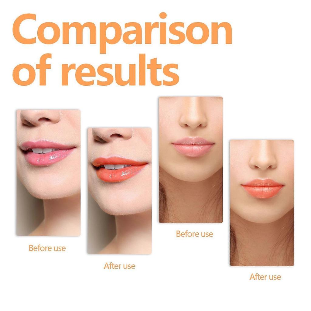 Changing Lip Oil, Mildly Removes The Lips Cutin Plentiful Full Fine Light Zerun Lip Oil