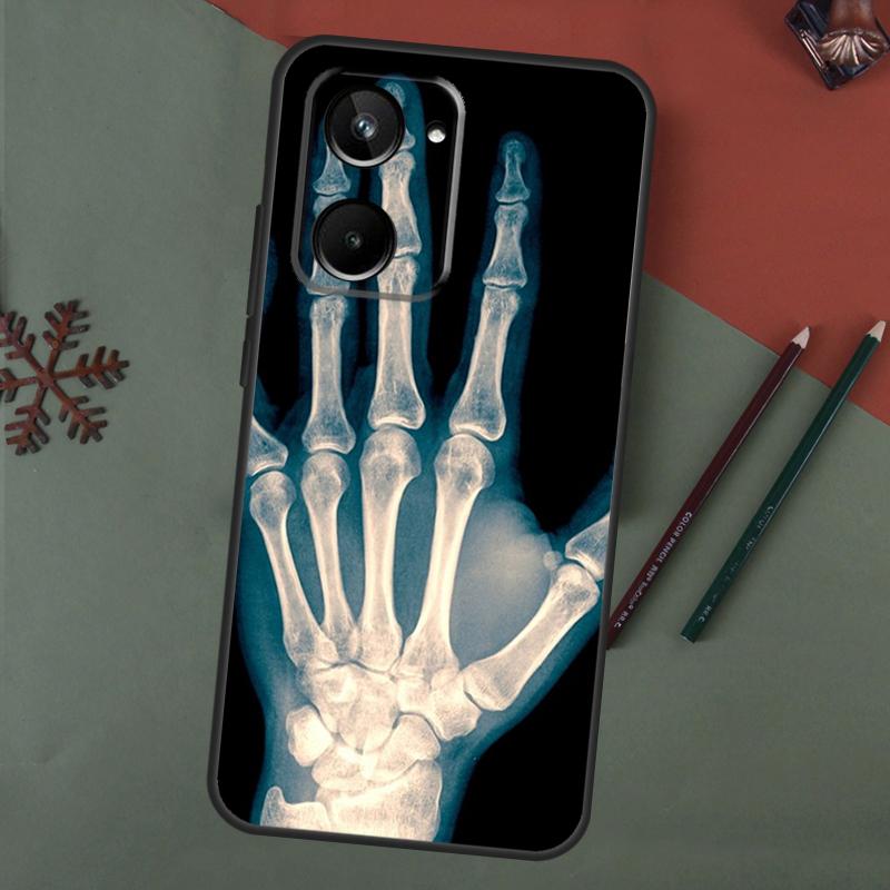Арт-кейс 'Скелет' для Realme 15 Pro GT7 GT6 C65 C67 C61 C53 C55 C51 C35 C63 C71 C75 11 12 13 14 Pro Plus