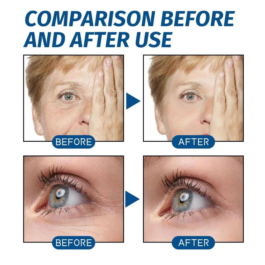 Крем для лица 2,5% Ретинол и Гиалуроновая кислота Антиоксидантный Антивозрастной Отбеливающий Осветляющий Увлажняющий Крем