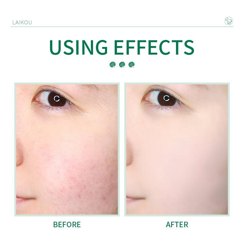 LAIKOU Успокаивающая пенка для умывания с центеллой CICA, очищающая пенка для глубокого очищения пор, 50 г