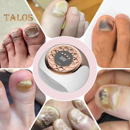 TALOS Профессиональный прибор для лечения ногтей с инфракрасным и синим светом для онихомикоза и сушки гель-лака