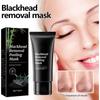 Blackhead Removal Mask Moisturizes The Face, Cleanses Blackheads And Acne, And Reduces Acne Marks