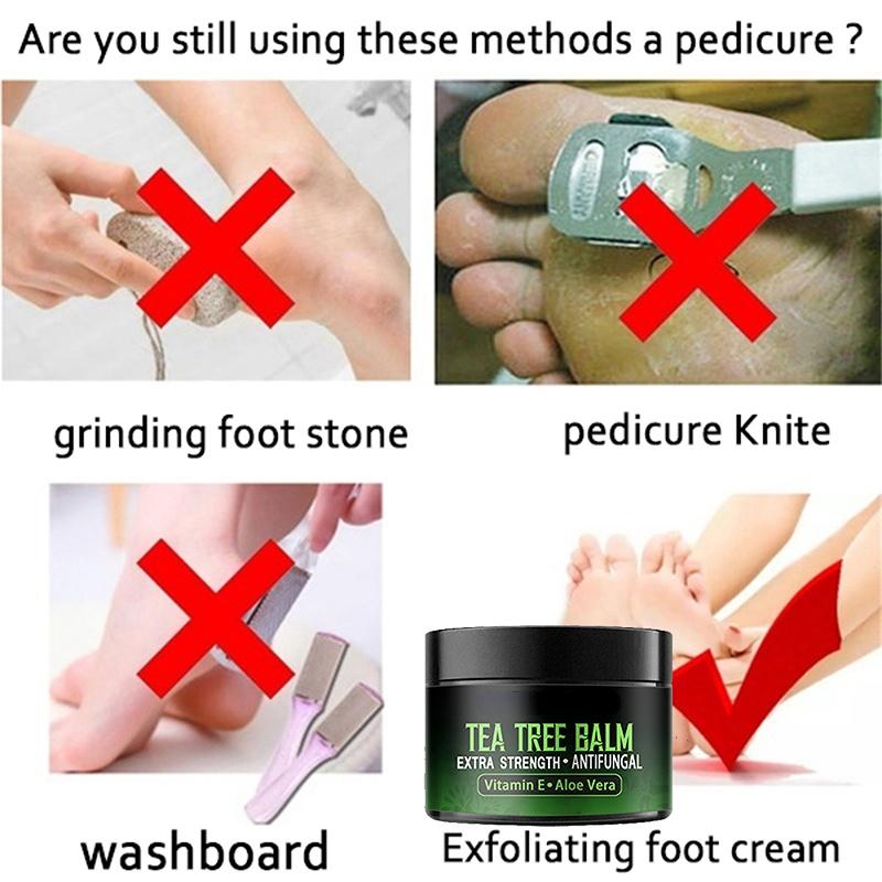 Крем для ног против высыхания трещин, крем для восстановления пяток, трещин, удаление омертвевшей кожи, уход за руками, ногами, уход за кожей рук и ног