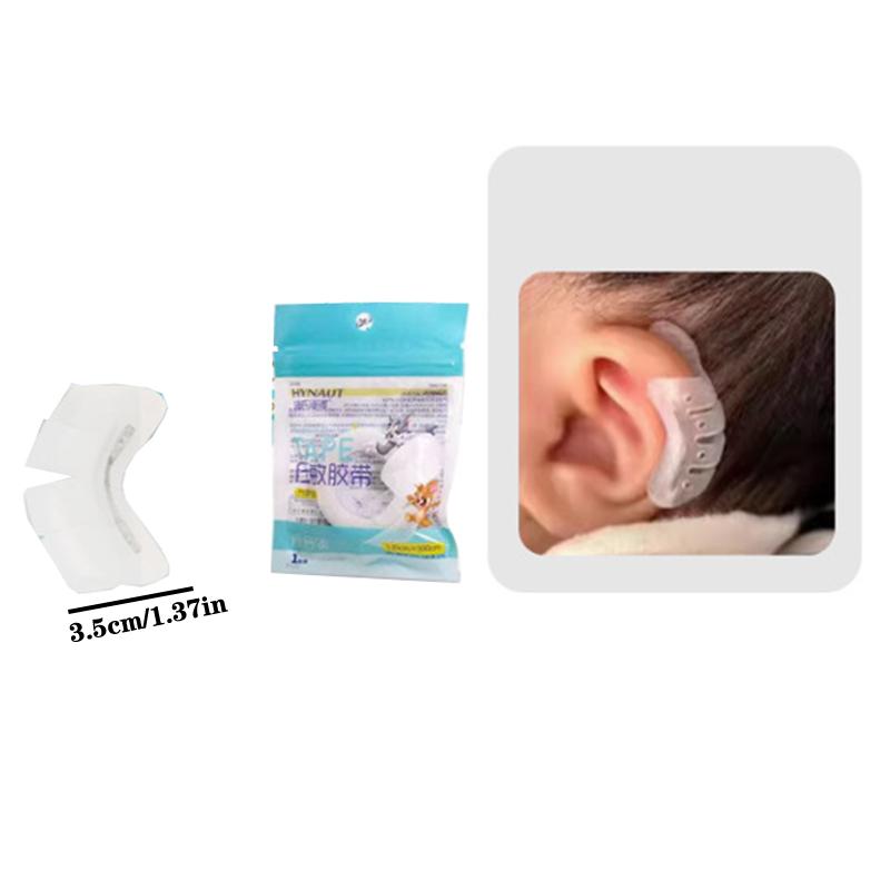 Выступающие ушные корректоры для младенцев, инструменты, силиконовая коррекция ушной раковины, корректор для детских ушей, вальгусная вальгусная деформация ушной раковины ребенка