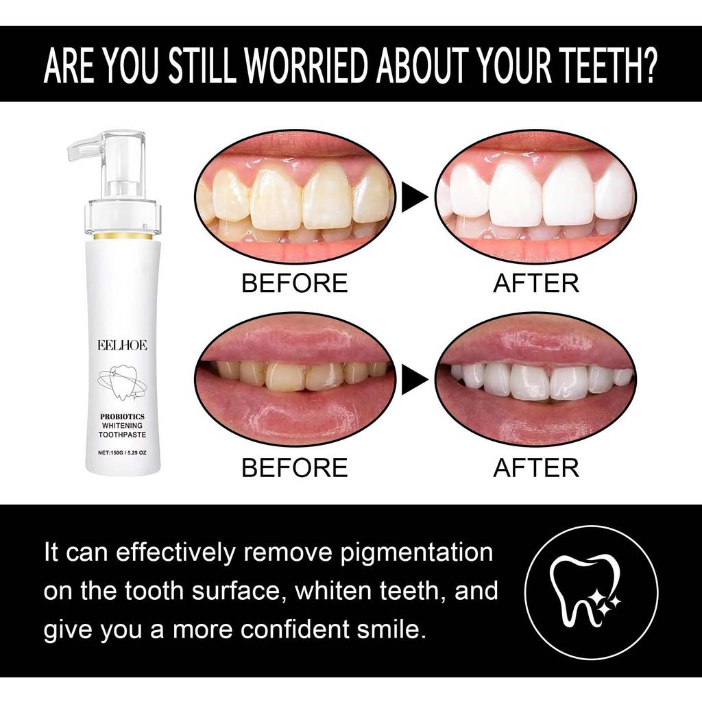 Eelhoe Teeth Cleansing Stains Removes Breath Freshen Teeth Whitening Mousse Oral Hygiene Mousse Foam Portable Travel Toothpaste 150ml