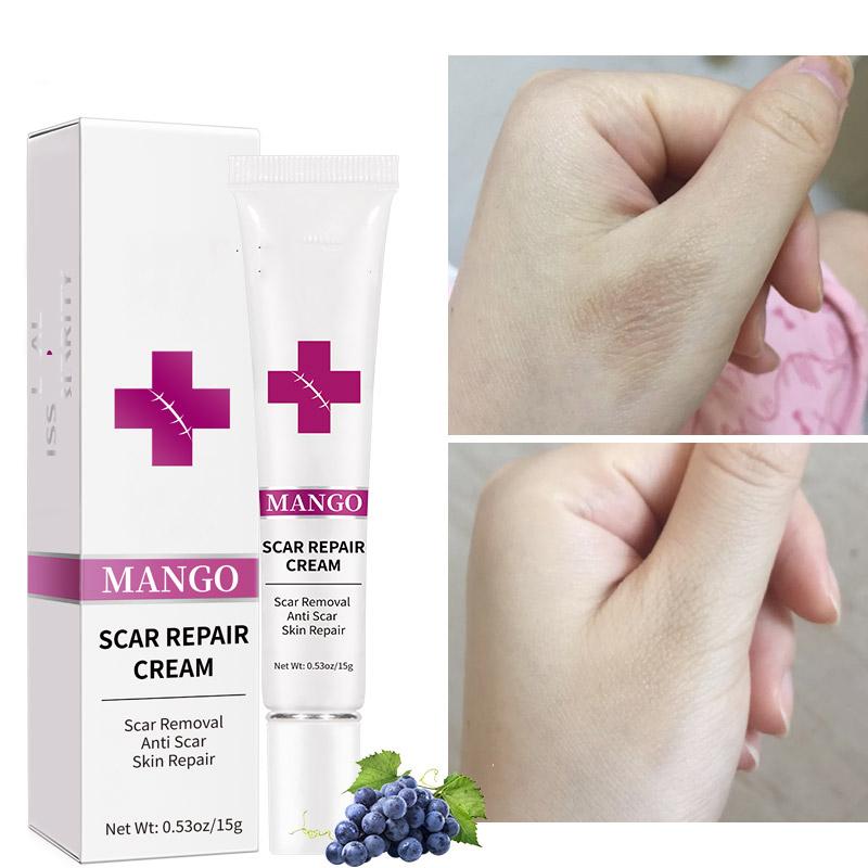 Нежная паста для удаления шрамов, восстанавливающий шрам, гель для уменьшения шрамов на коже, паста для уменьшения шрамов для всех типов кожи