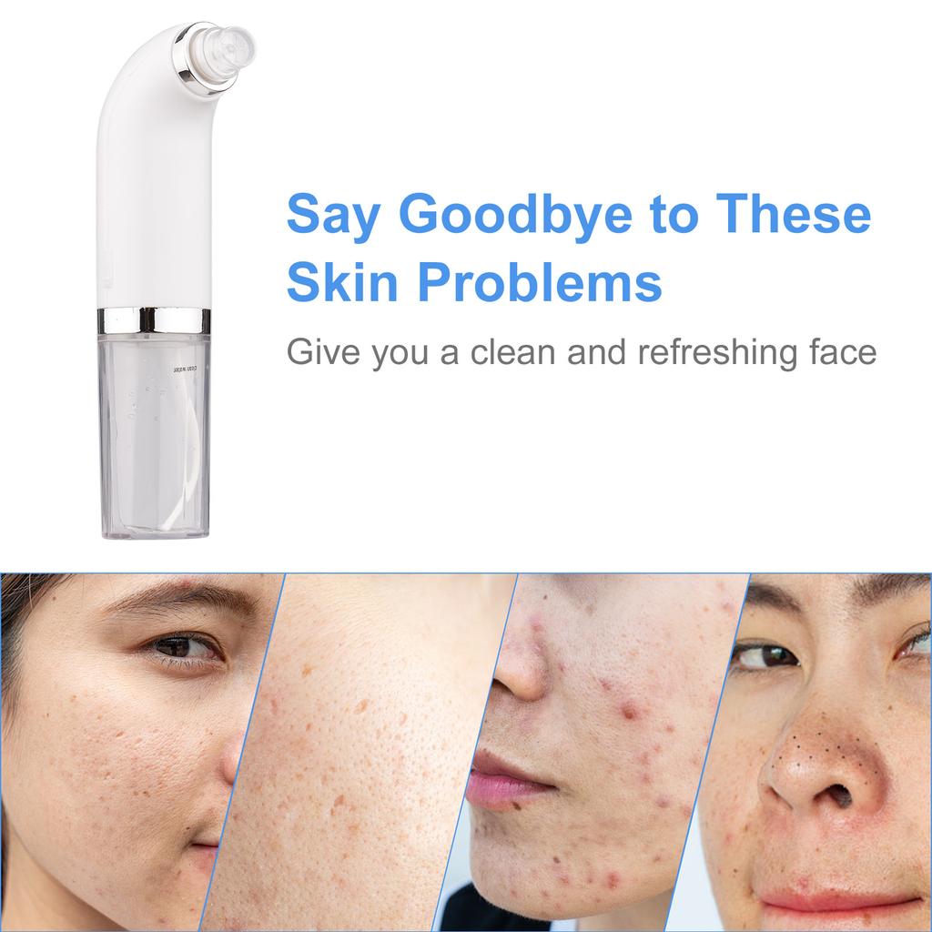 Переносной прибор для красоты с микропузырьками, электрический очиститель для лица, водный цикл, средство для удаления черных точек