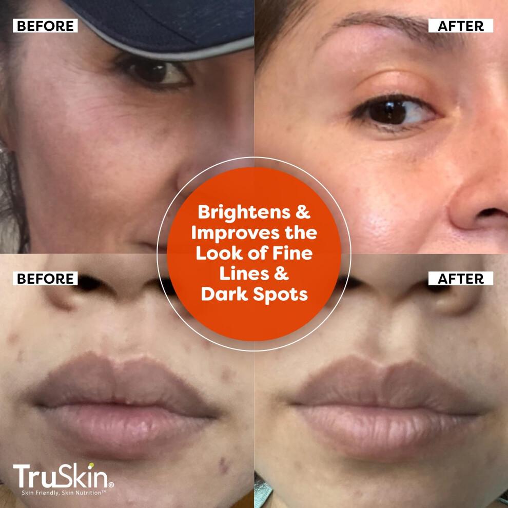 TruSkin Vitamin C Serum for Face ? Anti Aging Face Serum with Vitamin C, Hyaluronic Acid, Vitamin E ? Brightening Serum for Dark Spots, Even Skin