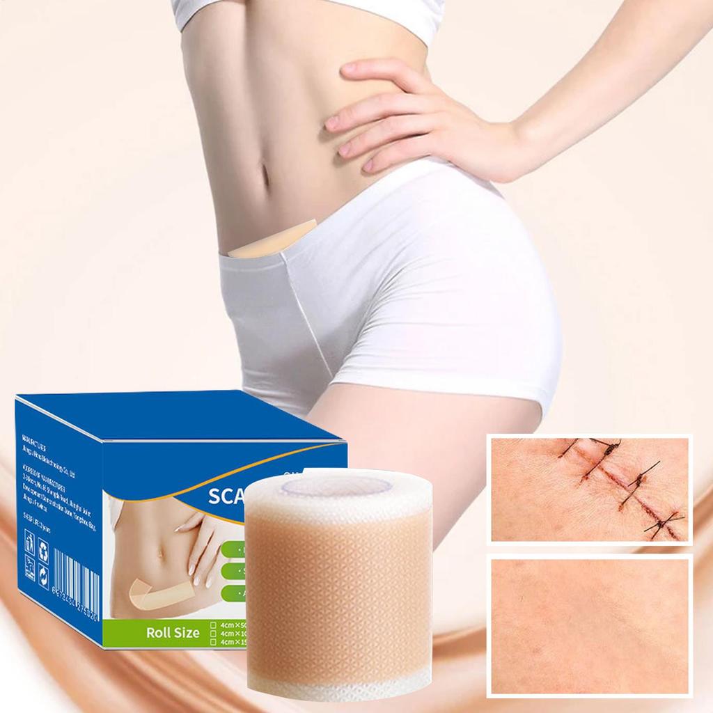 1 рулон силиконовых листов от шрамов, 4 см x 50 см силиконовых листов от шрамов, самоклеящаяся лента-заплатка от шрамов, уход за кожей, водонепроницаемая и дышащая