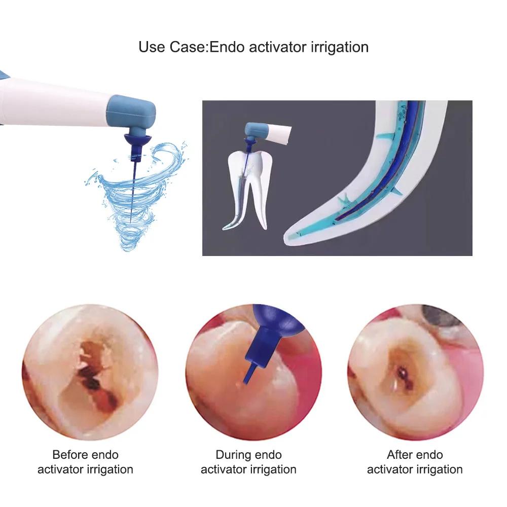 Стоматологический эндодонтический активатор для эндодонтической терапии корневых каналов в стоматологической клинике с 60 звуковыми ирригационными насадками стоматологические инструменты