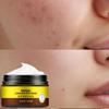 Acne Removing and Acne Removing Acne Repair and Desalination of Acne Print Cream