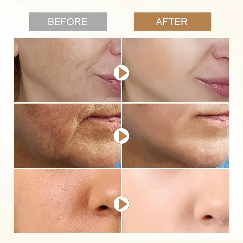 AUQUEST Крем для лица с ретинолом против морщин, отбеливающий, для удаления темных пятен, крем для лица, антивозрастной, с гиалуроновой кислотой, средства по уходу за кожей