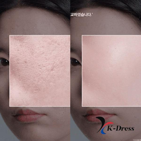 Medicube Zero Pore Pad 2.0