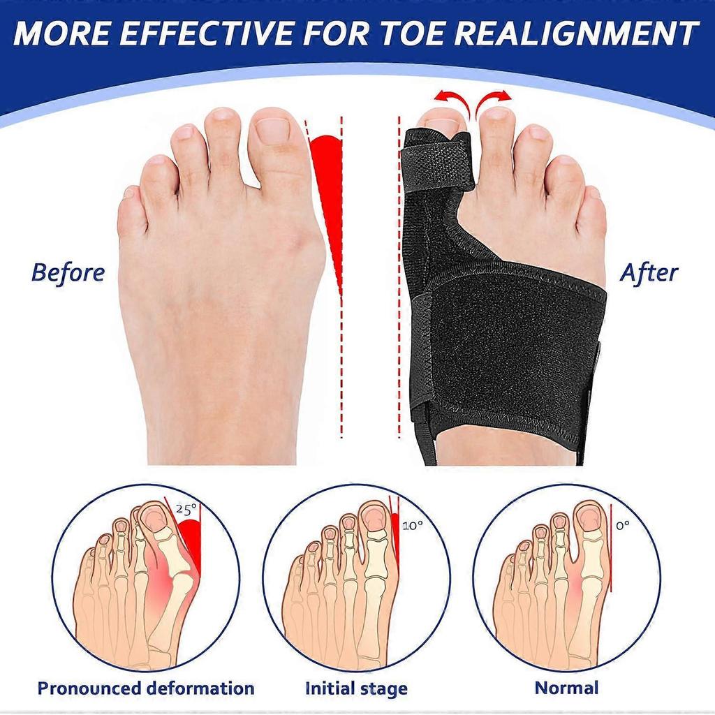 Bunion Corrector Adjustable Splint for Big Toe Alignment Pain Relief Day Night Use Black 1 Pair