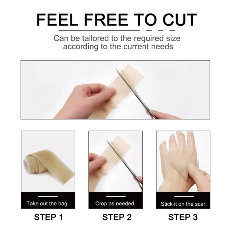 Силиконовый пластырь для шрамов Nude Scar Tape Roll Scar Sheet Removal Self-Adhesive Tape Therapy Patch Burn Acne Surgical Scar Skincare