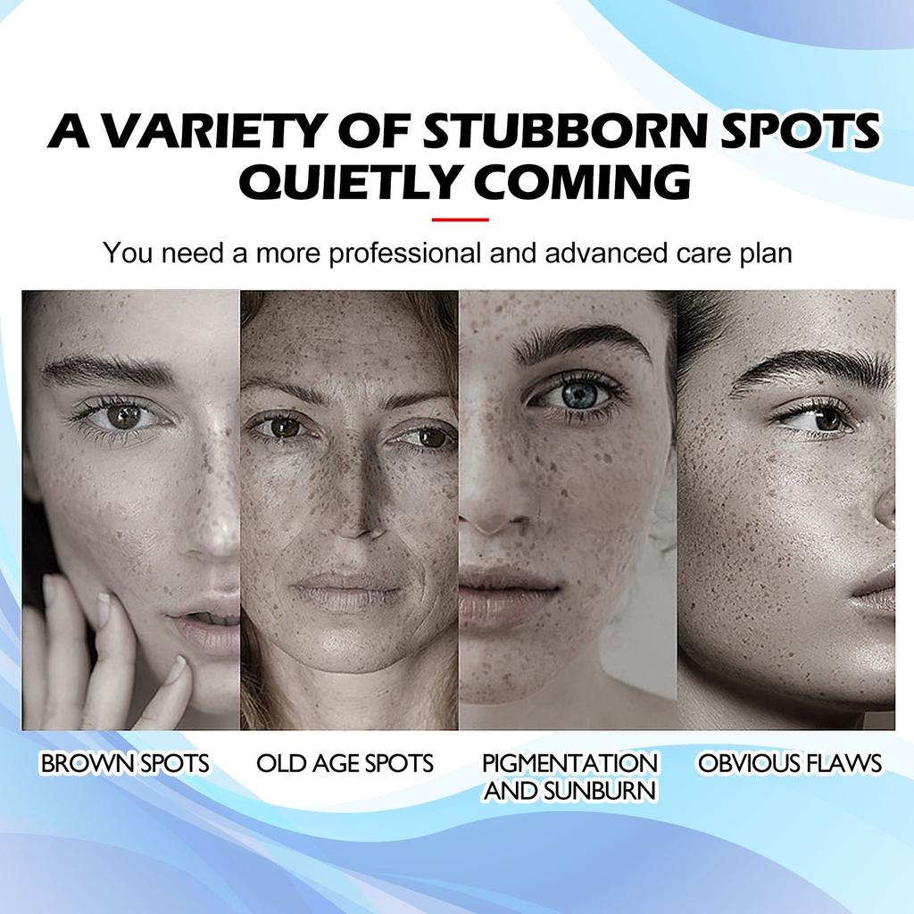 Средство для удаления темных пятен на лице, корректор темных пятен, средство для удаления темных пятен от солнца, пигментных пятен, коричневых пятен, шрамов от угревой сыпи, средство для удаления темных пятен на теле, руках, подмышках, ногах. 30 мл