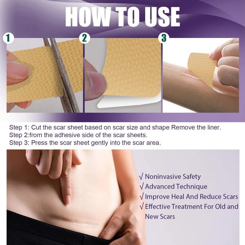 Eelhoe Silicone Scar Patches For Reducing Pregnancy And C-section Scars Effectively