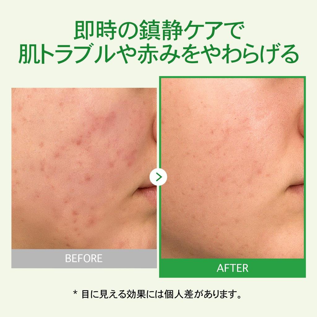 TOSOWOONG Madagascar Centella Cream Centella Asiatica and for Combination and Oily by Korean Skincare Cosmetics 50ml, (Centella asiatica)