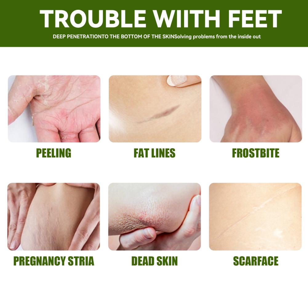 50g Urea Foot Cream Hand Anti Cracking Moisturizing Calluses Dead Skin Repair Rehydration Soften Cuticle Smooth Restore