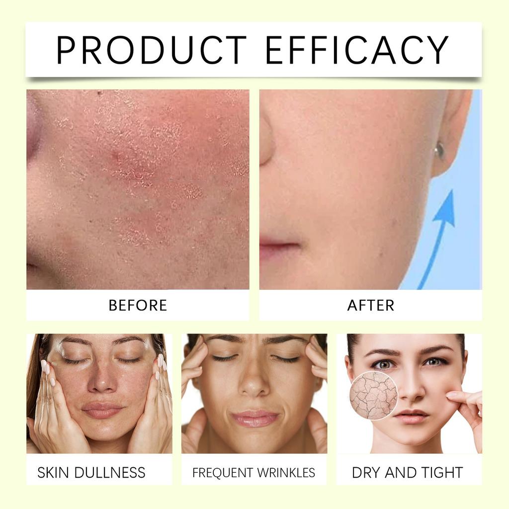 Butter Honey Nourishing Moisturizer Deep Moisturizing Soothing Dry Gentle Nourishing And Winter Cream Light And Easy To Absorb