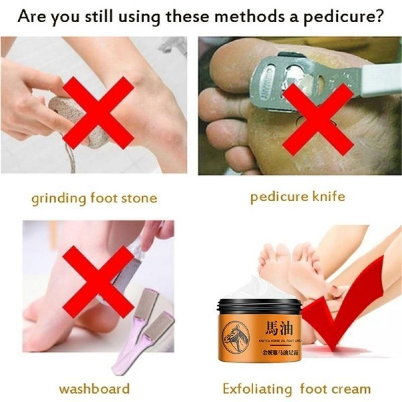 Крем для восстановления рук и ног с лошадиным маслом. Крем для ухода за ногами. Крем для ухода за бери-бери и зудом на ногах.