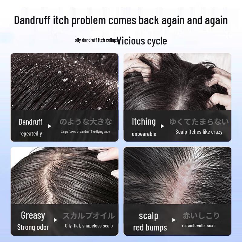 Nanjing Tongrentang Selenium Disulfide Anti-Dandruff Shampoo