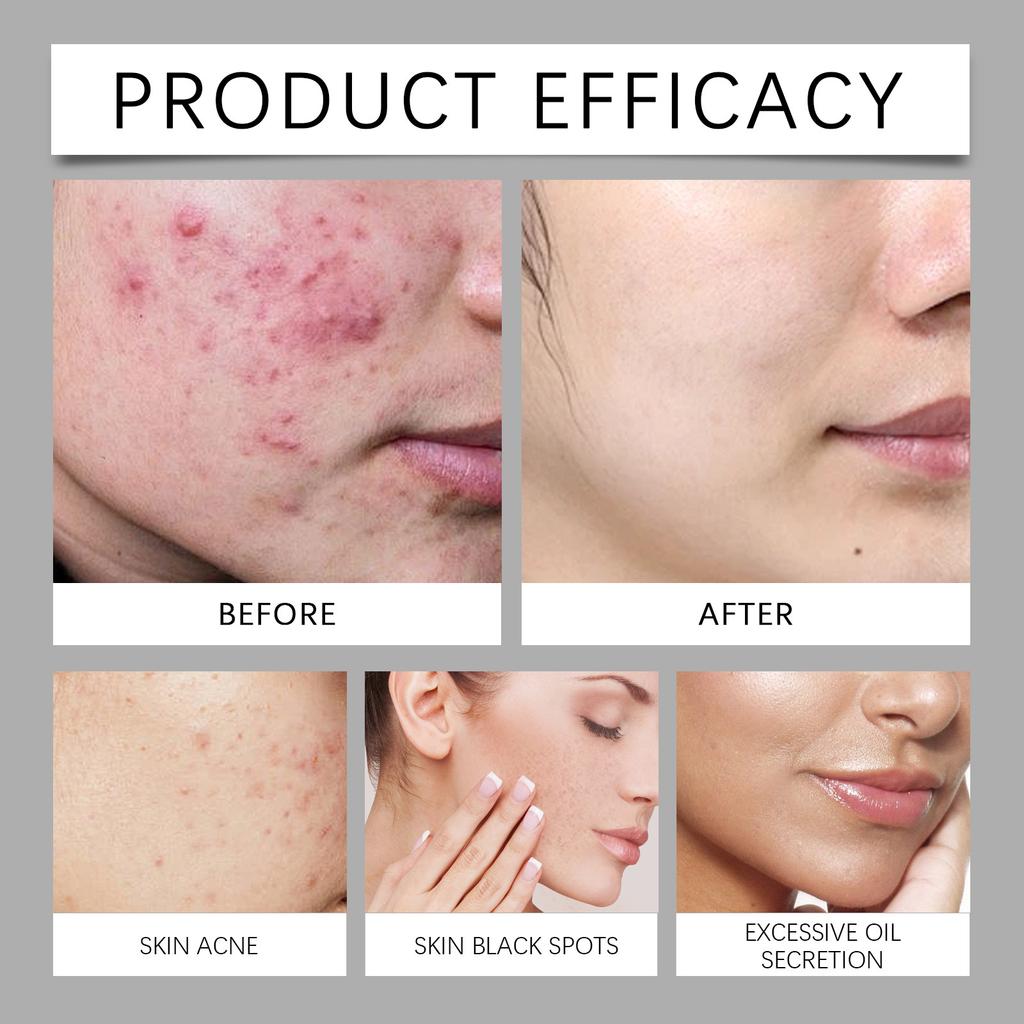 Индивидуальное очищающее средство для лица с аминокислотами, мягкие ингредиенты, подходящие для разных типов кожи, очищающие и увлажняющие эффекты