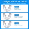 3 этапа стоматологические ортодонтические брекеты фиксатор для зубов при бруксизме каппа выпрямитель для зубов стоп устройство против храпа