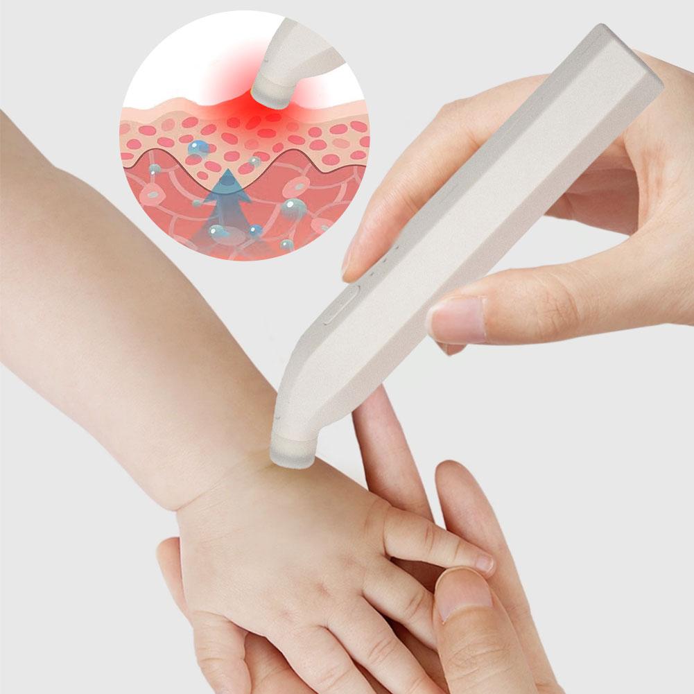 Электронная ручка от комариных укусов, ручка для снятия зуда от укусов насекомых без химикатов, ручка против зуда для взрослых и детей, для кемпинга, путешествий, улицы