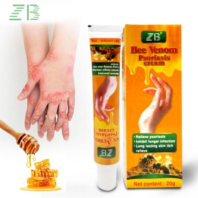 Крем для ухода за кожей Bee Venom, китайский, для массажа ног, внешний, многофункциональный, для зуда