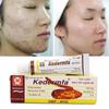 5g Vietnam Kedermfa 100% Original Snake Oil Hand Skin Face Care Cream Snake Balm Ointment Nourish