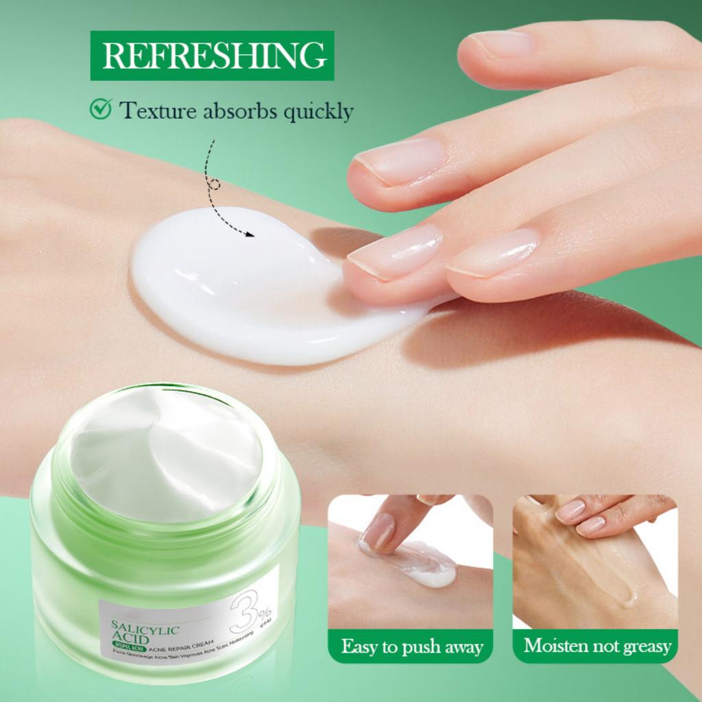 Салициловый крем от прыщей, увлажняющий крем от прыщей, уход за кожей, увлажняющий уход за кожей