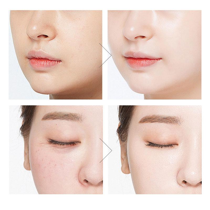 Фуллереновые капсулы с плацентой, укрепляющая кожу, отбеливающая сыворотка для лица против морщин