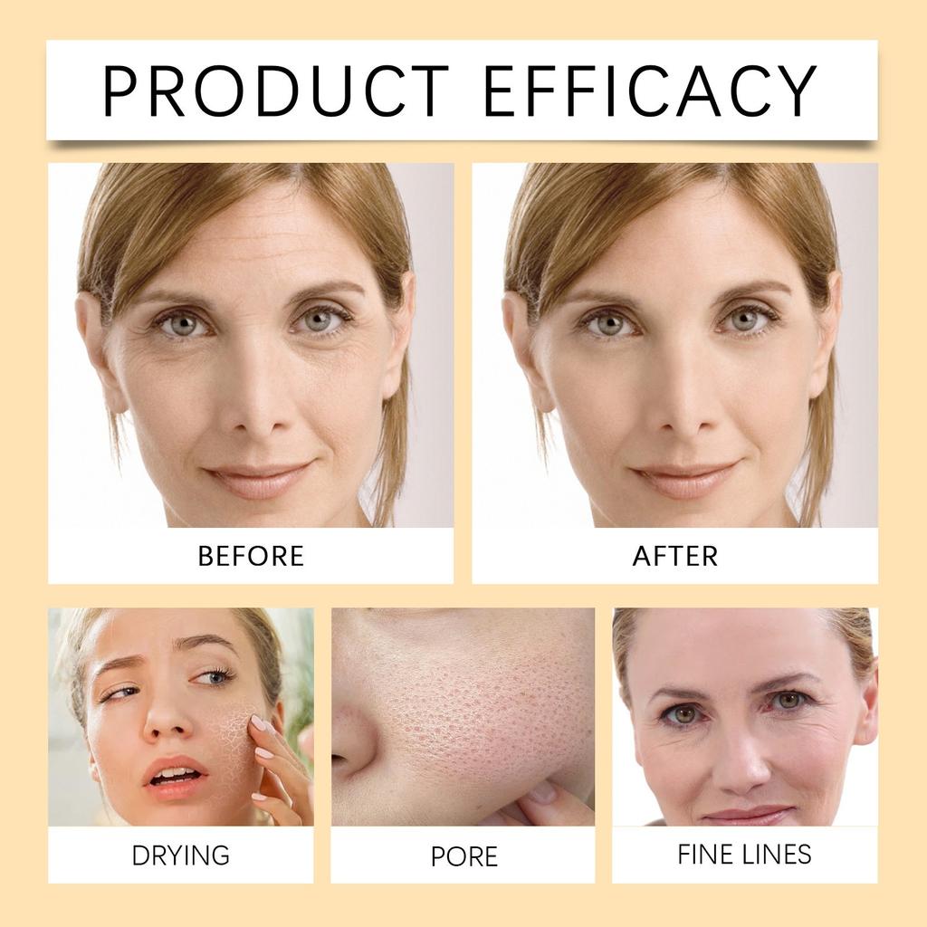 Осветляющий батончик для кожи, батончик, уменьшает темные пятна, гиперпигментацию и другие виды повреждений кожи, 100 г