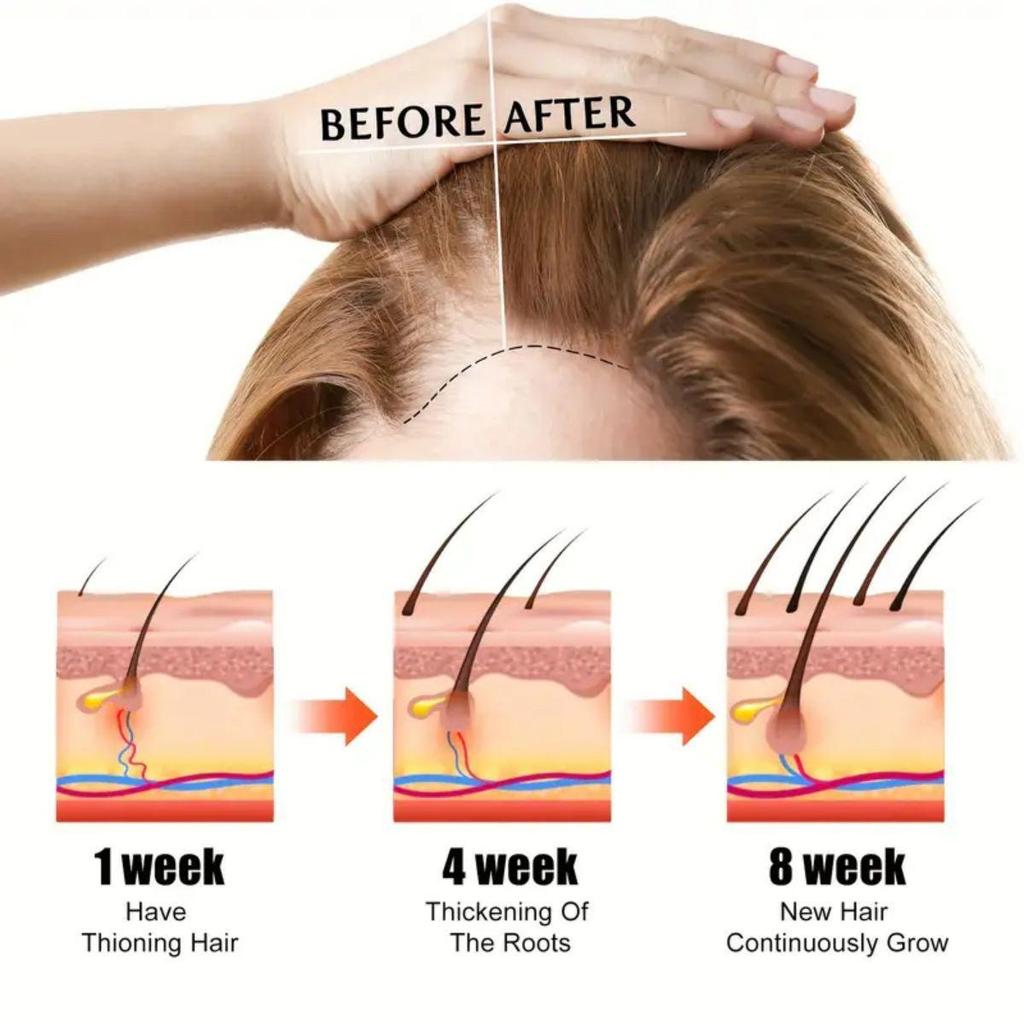 Сыворотка для роста ресниц, касторовое масло, эссенция, средство для укрепления ресниц, средство для увеличения бровей, удлинение, более густые ресницы, лифтинг, уход за глазами