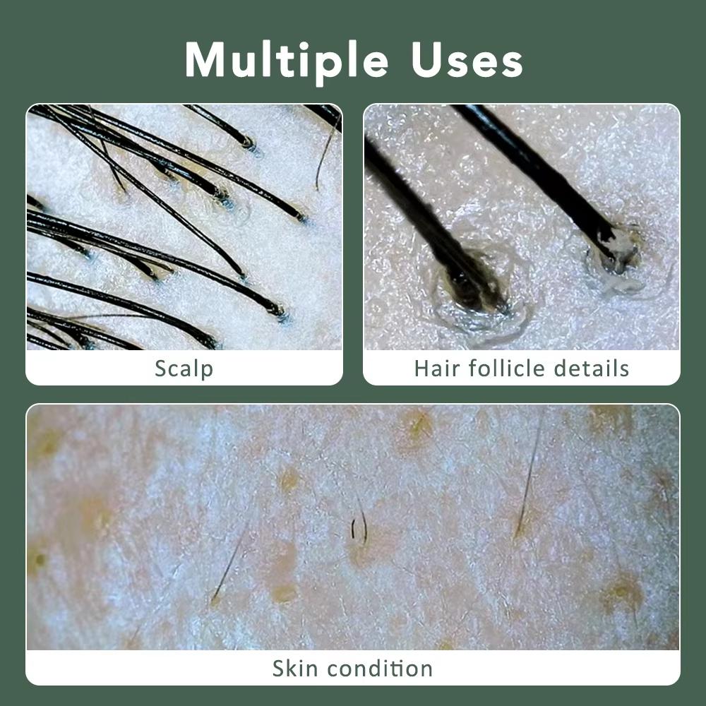 Многофункциональный детектор волосяных фолликулов кожи головы, визуальный анализатор кожи, увеличительное стекло, дерматоскоп, подключение к телефону и планшету