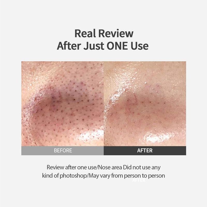 SUNGBOON EDITOR Пилинг-пэды для удаления черных точек 65г (30 шт.)