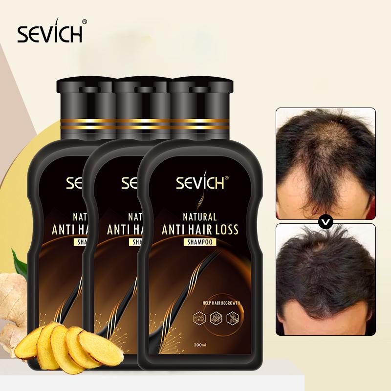 SEVICH 3 шт./компл., 200 мл, шампунь против выпадения волос, имбирь, рост волос, эссенция растений, гель, натуральный шампунь для лечения выпадения волос, уход за волосами