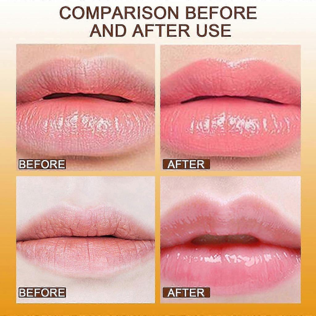 Hydrating Lip Balm with Beeswax & Shea Butter Anti-Cracking, Reduces Lip Lines, Overnight Lip Mask, Non-Greasy, 20ml