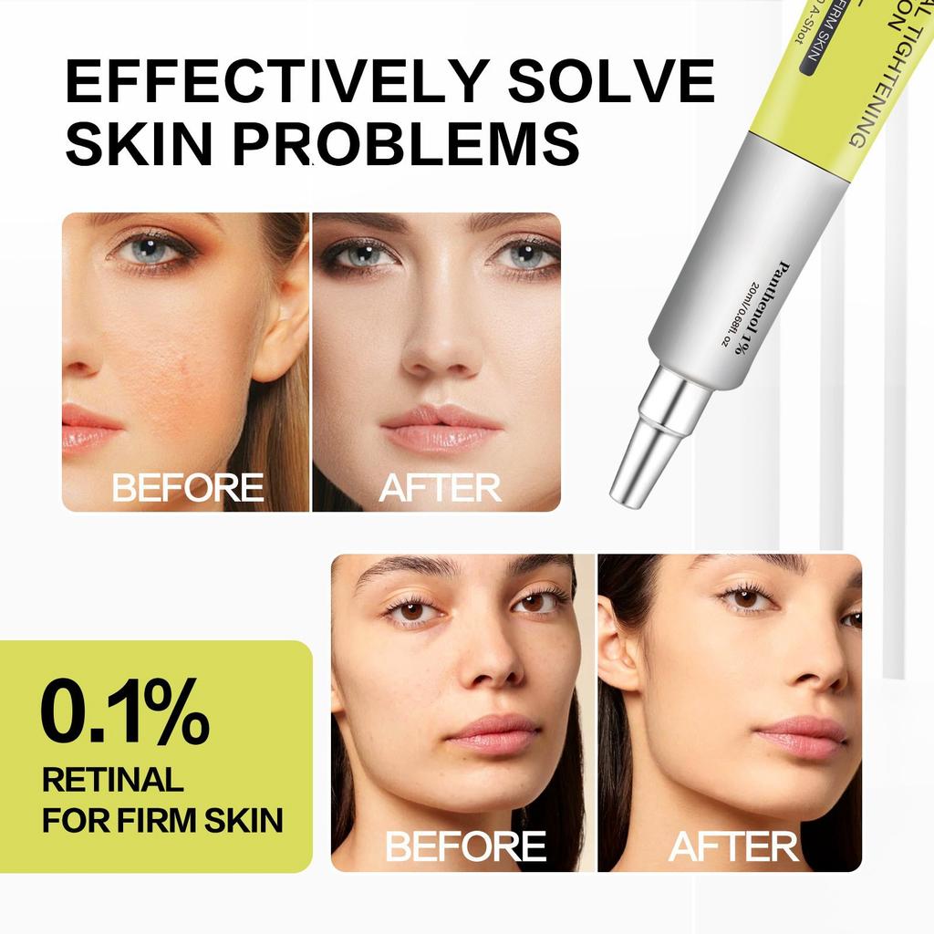 Retinol Eye Cream Tightens, Moisturizes, And Soothes The Eye Skin. Moisturizing Massage Moisturizes And Tightens The Eye Skin.