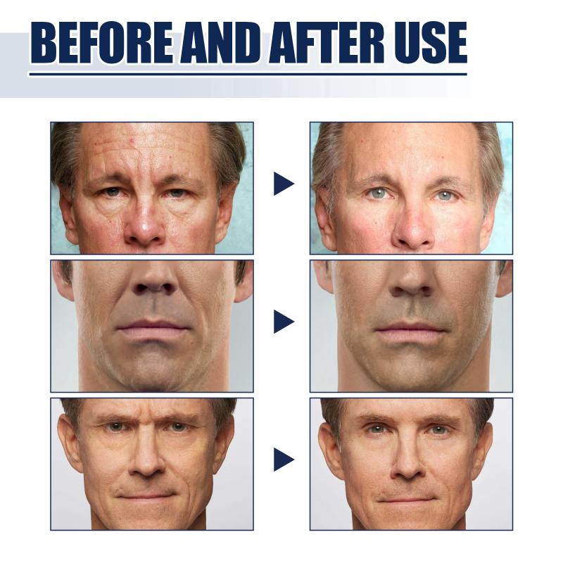 Mens Facial Firming Set With Anti Aging Effect Reduces Lines Forehead Smooths Nasolabial Fold Moisturizer For Daily Care