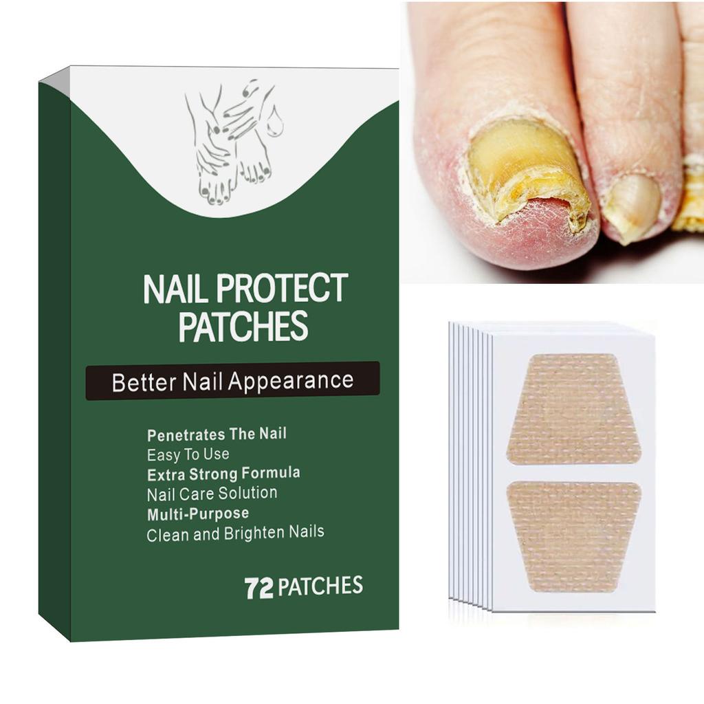 Руки и ноги Мягкие ногти Инкрустированные ногти Утолщение Яркие борозды для ногтей Серые патчи для ухода за ногтями