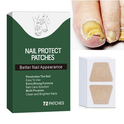 Руки и ноги Мягкие ногти Инкрустированные ногти Утолщение Яркие борозды для ногтей Серые патчи для ухода за ногтями