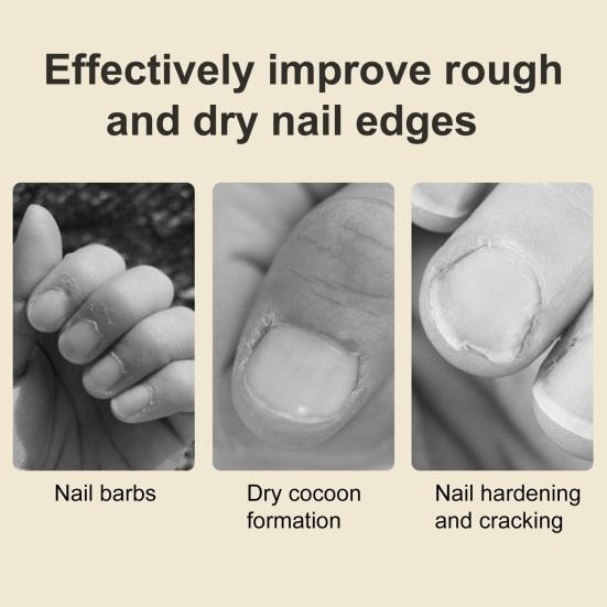 Масло для роста ногтей, омолаживающее питательное масло для ногтей, для роста и укрепления, масло для кутикулы, компактная масляная кисточка для питания на ходу