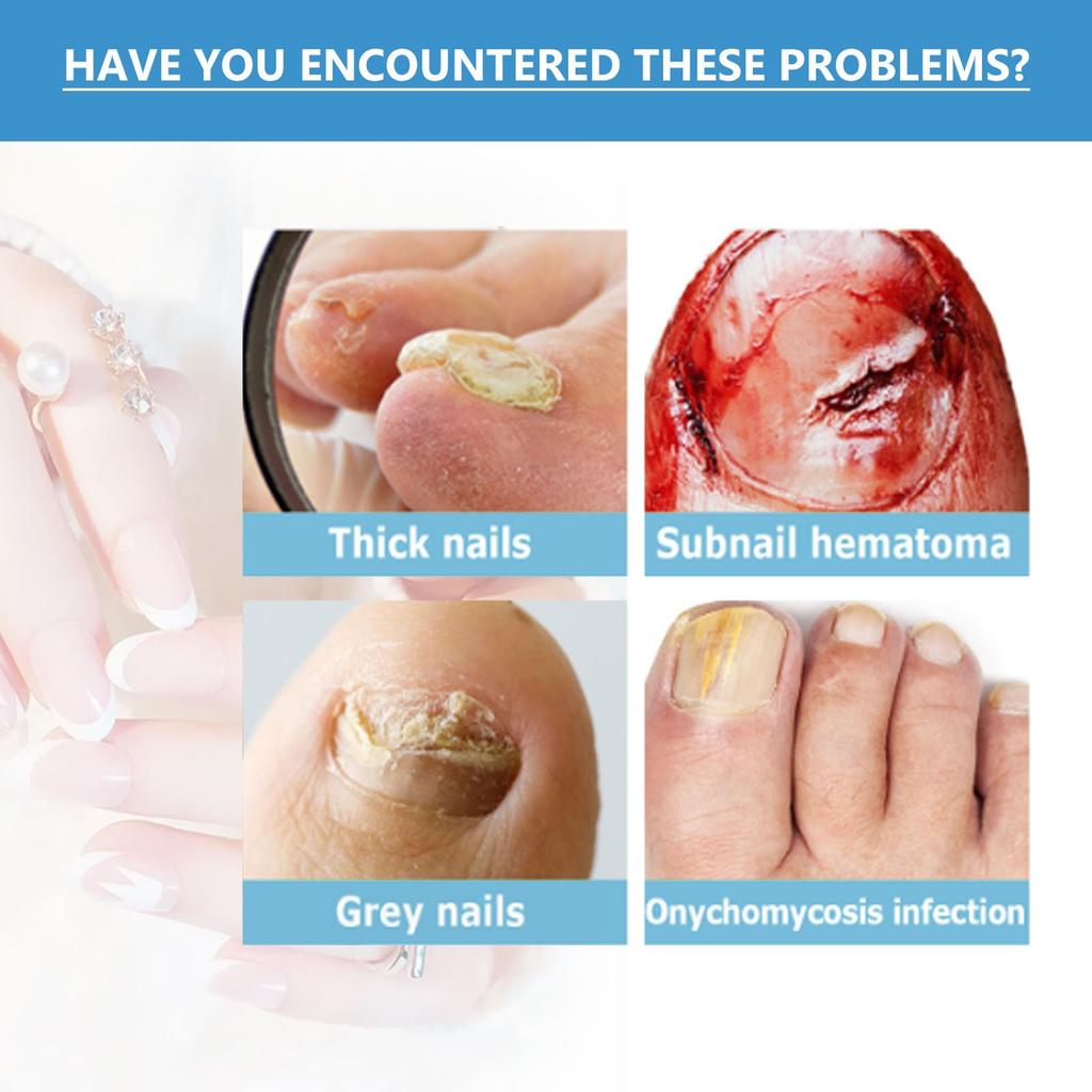 Многофункциональные наклейки для ухода за ногтями, уход за поврежденными ногтями, эффективно улучшают внешний вид поврежденных ногтей на руках и ногах