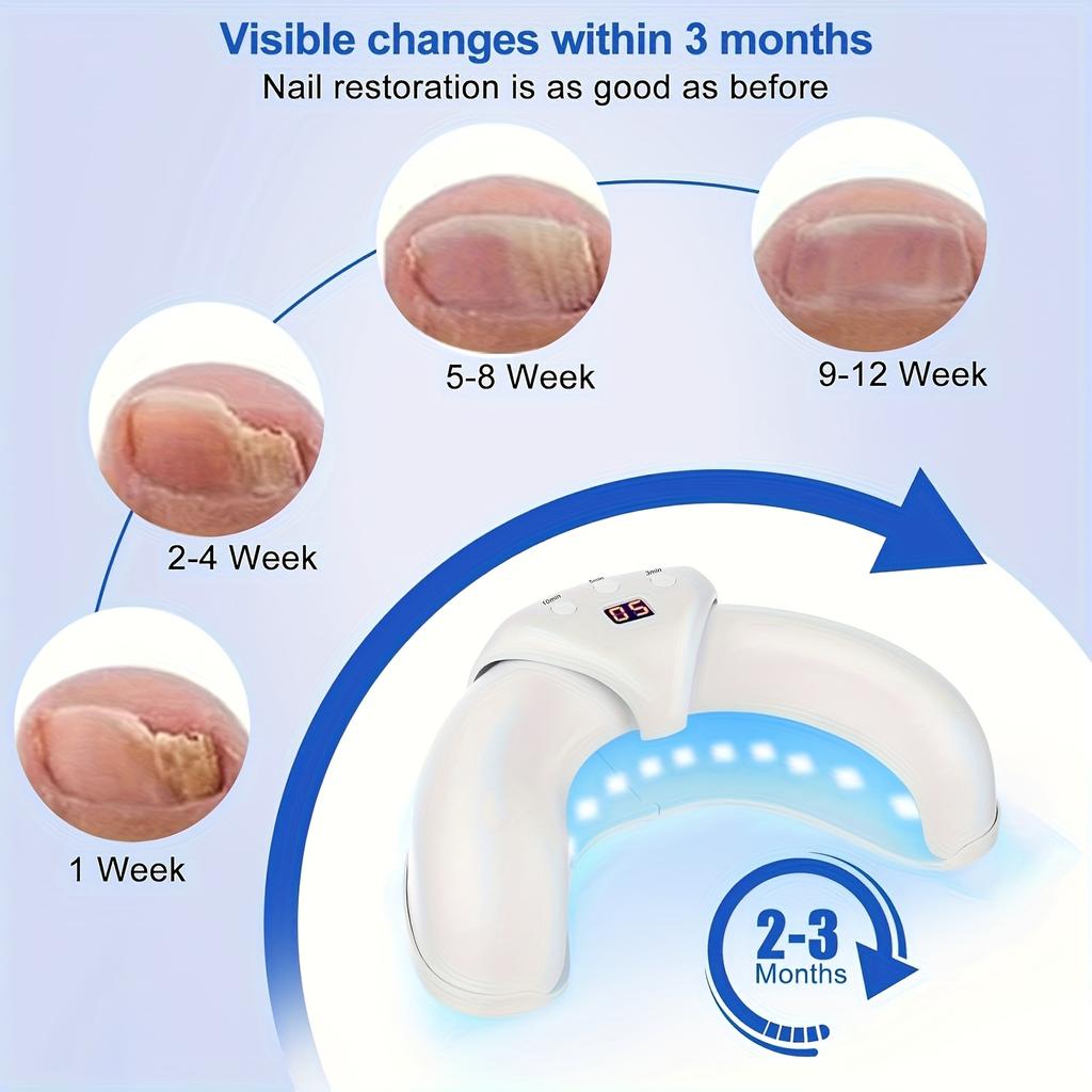 Лазерный стерилизатор для ногтей, в 2 раза более быстрое удаление и восстановление плесени, специально для ногтей с несколькими пальцами, складное оборудование для очистки от плесени