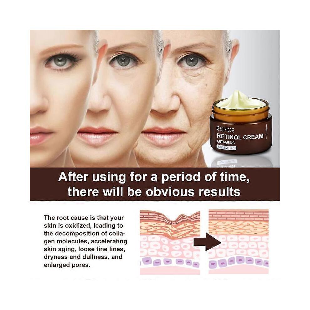 (2pcs) 1-3 Stück Retinol-Gesichtscreme: Anti-Aging, Straffung & Aufhellung